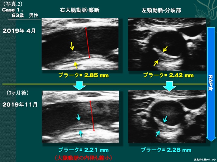 リスクは何ですか?